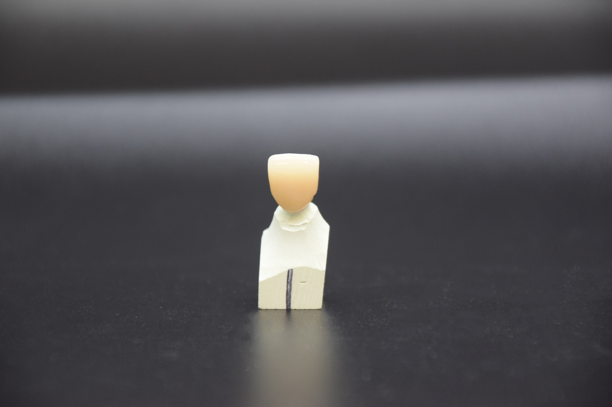 Corona in zirconio-ceramica
